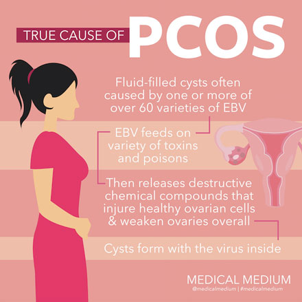 True Cause of PCOS